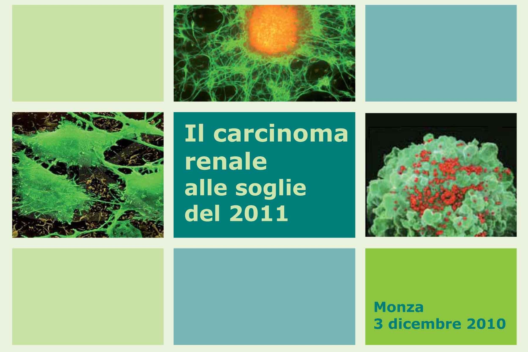 Carcinoma Renale alle soglie del 2011